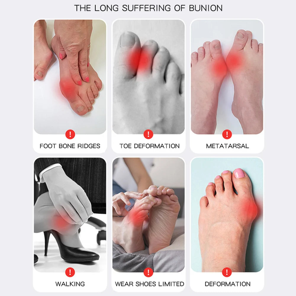 Bunion Corrector Adjustable Socks - OmniOfferings