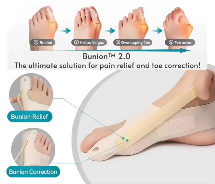 The Original Bunion Corrector Socks. 10 gempages 519647500169118897 6f819a3c 46af 478b ba4a e4cb80203a91